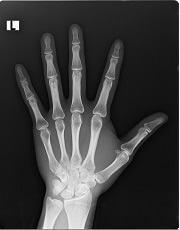 X-ray写真