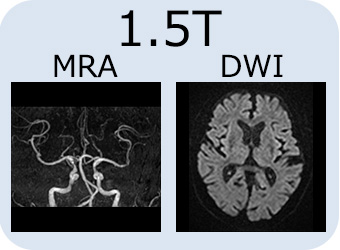 MRI検査画像